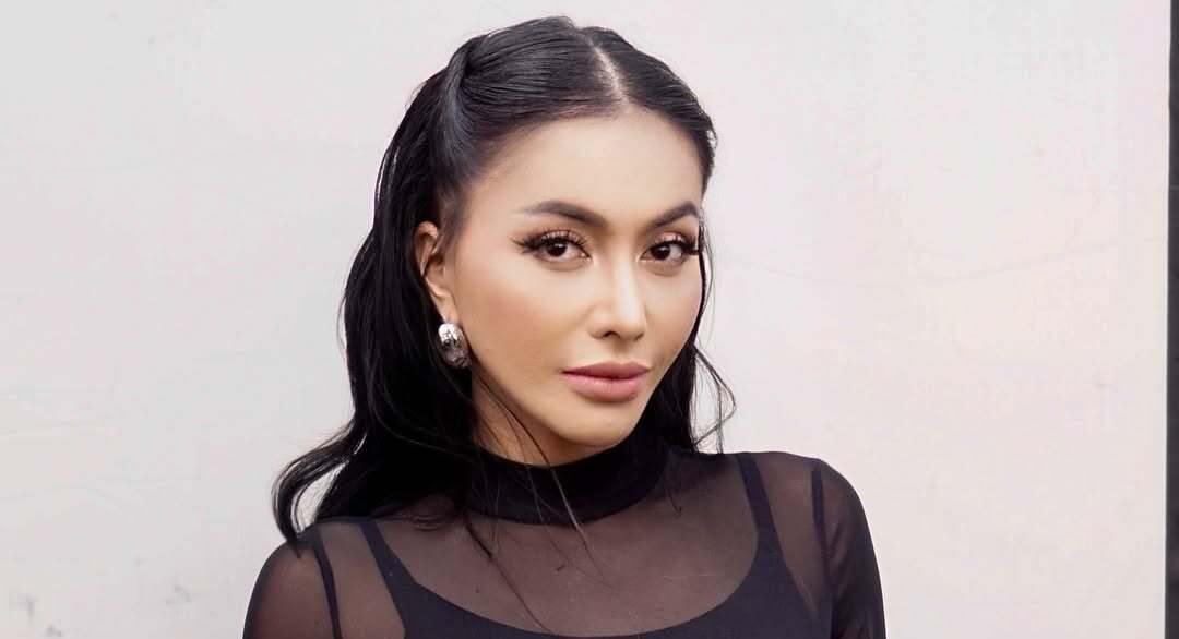 Baru Oplas, Hidung Denada Terbentur Kaca Mobil