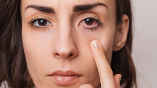 Anak Muda Waspada Retinopati Diabetik, Diabetes Bisa Berujung Kebutaan