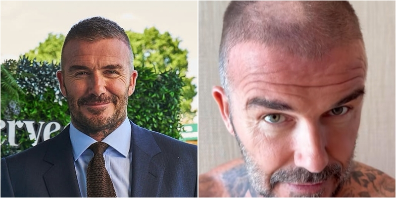 Victoria Ngakak, Kepala David Beckham Jadi Pitak