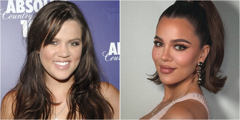 Khloe Kardashian Bongkar Oplas yang Pernah Dilakukan