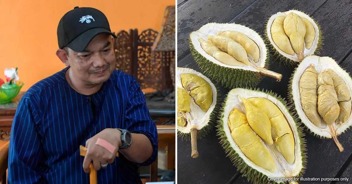 Kebanyakan Makan Durian, Musisi Malaysia ini Alami Stroke