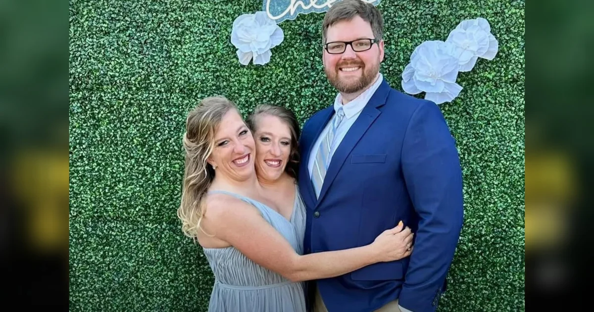 Kembar Siam Abby dan Brittany Hensel Diduga Punya Bayi