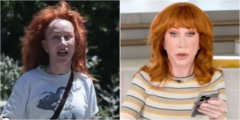 Kena Nyinyir Netizen, Kathy Griffin Pilih Oplas Facelift Lagi