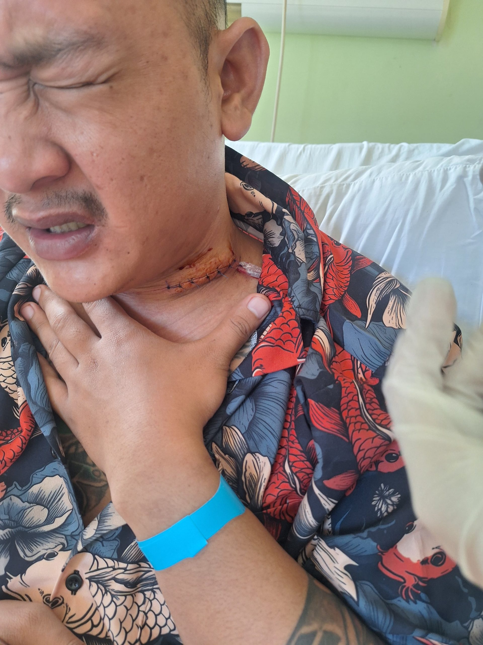 Petugas Jaga Malam PT SJIM Ditikam Orang Tak Dikenal Luka Sayatan Leher