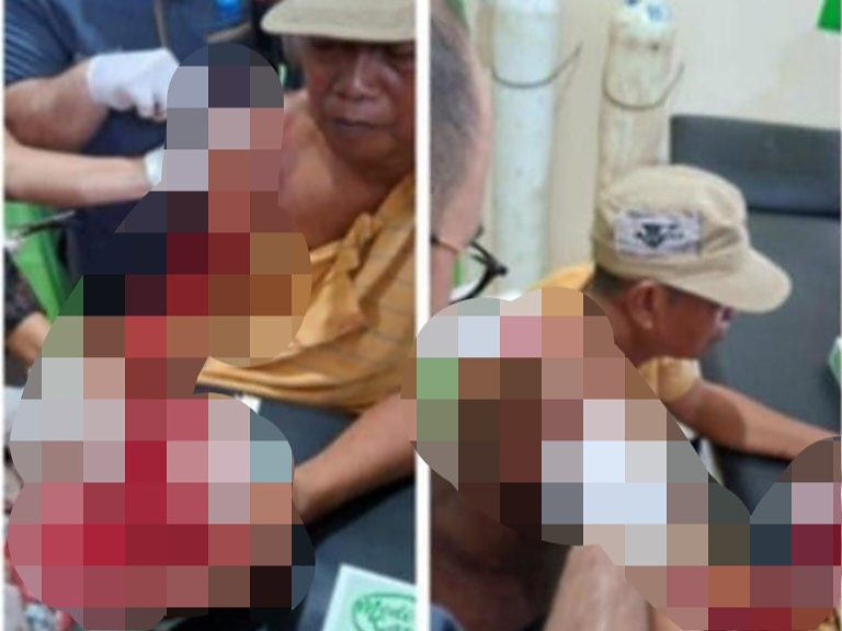 Kakek Suyadi Dibegal saat Pulang dari Ladang, Motor Dirampas dan Jari Tangan Putus Ditebas