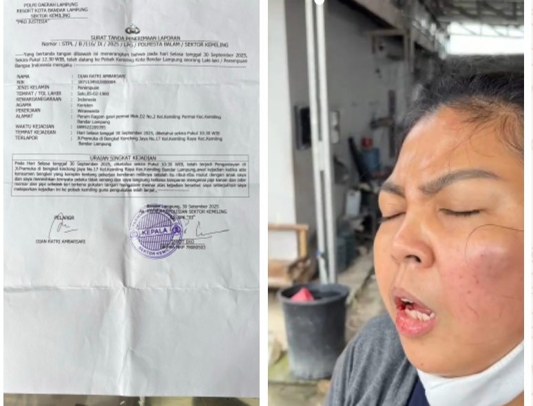 Pemilik Bengkel Kinclong Jaya Ternyata Korban Penganiayaan Pelanggan Bukan Pelaku