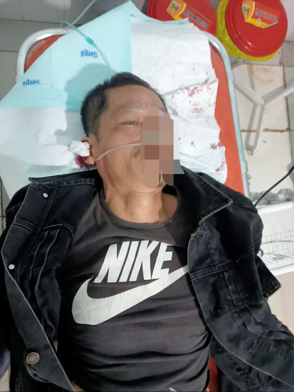 Lubang Jalan di Tanggamus Telan Korban, Proyek Tambal Sulam Disorot “Asal Kerja, Nyawa Taruhan”