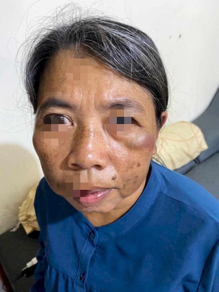 Oknum Dokter Puskesmas ASN di Bandar Lampung Dilaporkan Kerap Aniaya Pembantunya?