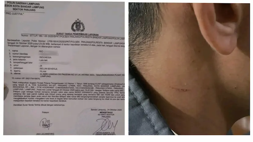 Tak Terima Dilerai Dalam Keributan Karyawan Pelabuhan Pelindo Panjang Ngamuk Kalungkan Celurit Leher Satpam