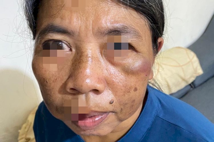 Polresta Bandar Lampung Mulai Usut Dokter Aniaya Pembantunya