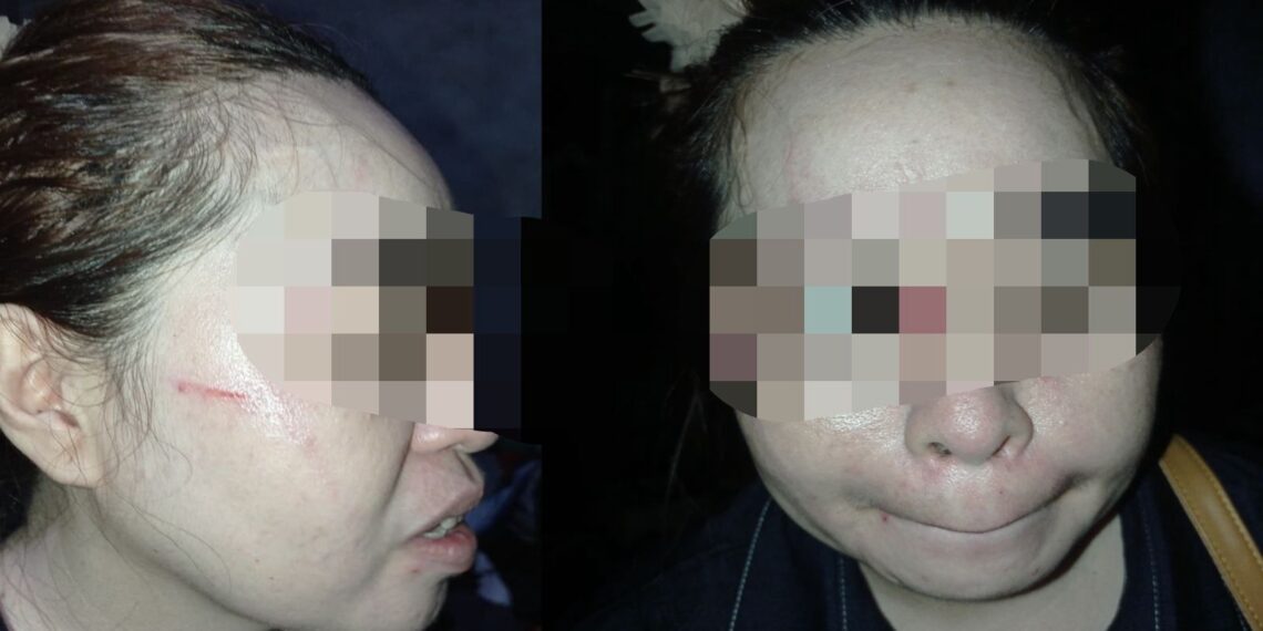 Diduga Cemburu Pegawai P3K Istri Siri Oknum Polisi Cakar Perempuan di Buton Utara