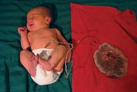 Warga Sukarame Geger, Bayi Berbungkus Plastik Merah Ditemukan di Semak-Semak Jelang Lebaran