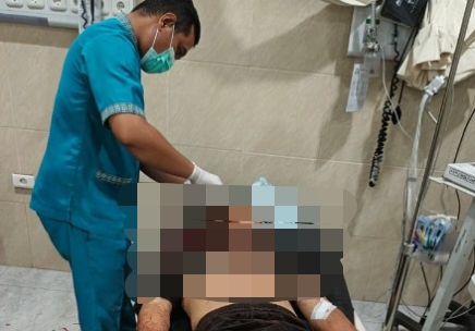Tawuran Berdarah di Bumi Waras: Pemuda 21 Tahun Tewas Akibat Luka Bacok, Polisi Buru Pelaku