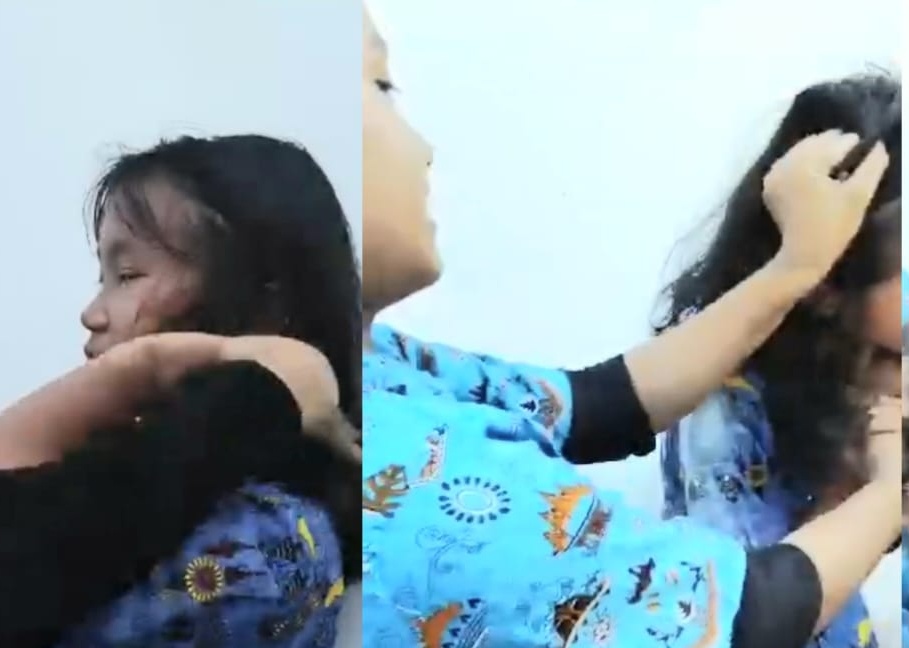 Viral Siswi SD di Lampung Timur Jadi Korban Perundungan, Alami Trauma dan Luka Memar