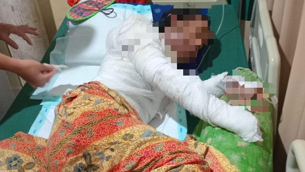 Suami di Metro Bakar Istri Yang Sedang Hamil, Terancam 10 Tahun Penjara