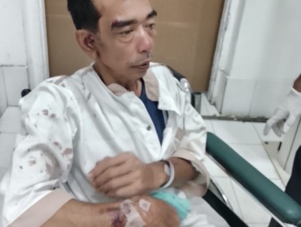 Dukun Cabul di Terbanggi Besar Babak Belur Dihajar Massa, Kabur Saat Dirawat di Rumah Sakit