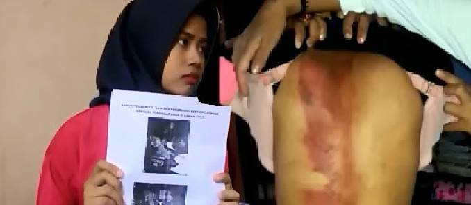 Dua Gadis Asal Tanggamus Disiksa Majikan Selama 3 Tahun di Jakarta