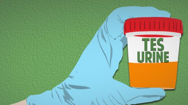 22 Wartawan Ikuti Test Urine BNNP Lampung