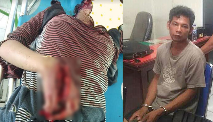 Ayah “Cacak” Anak Tirinya Yang Masih SD Hingga Kritis