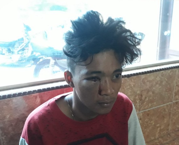 Rozi Babak Belur Dihajar Bokap Temannya