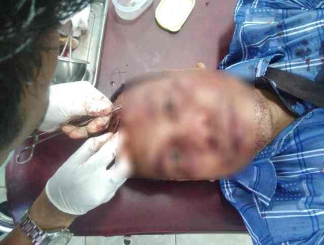 Kapolsek Kena Sabetan Badik Saat Grebek Bandar Sabu