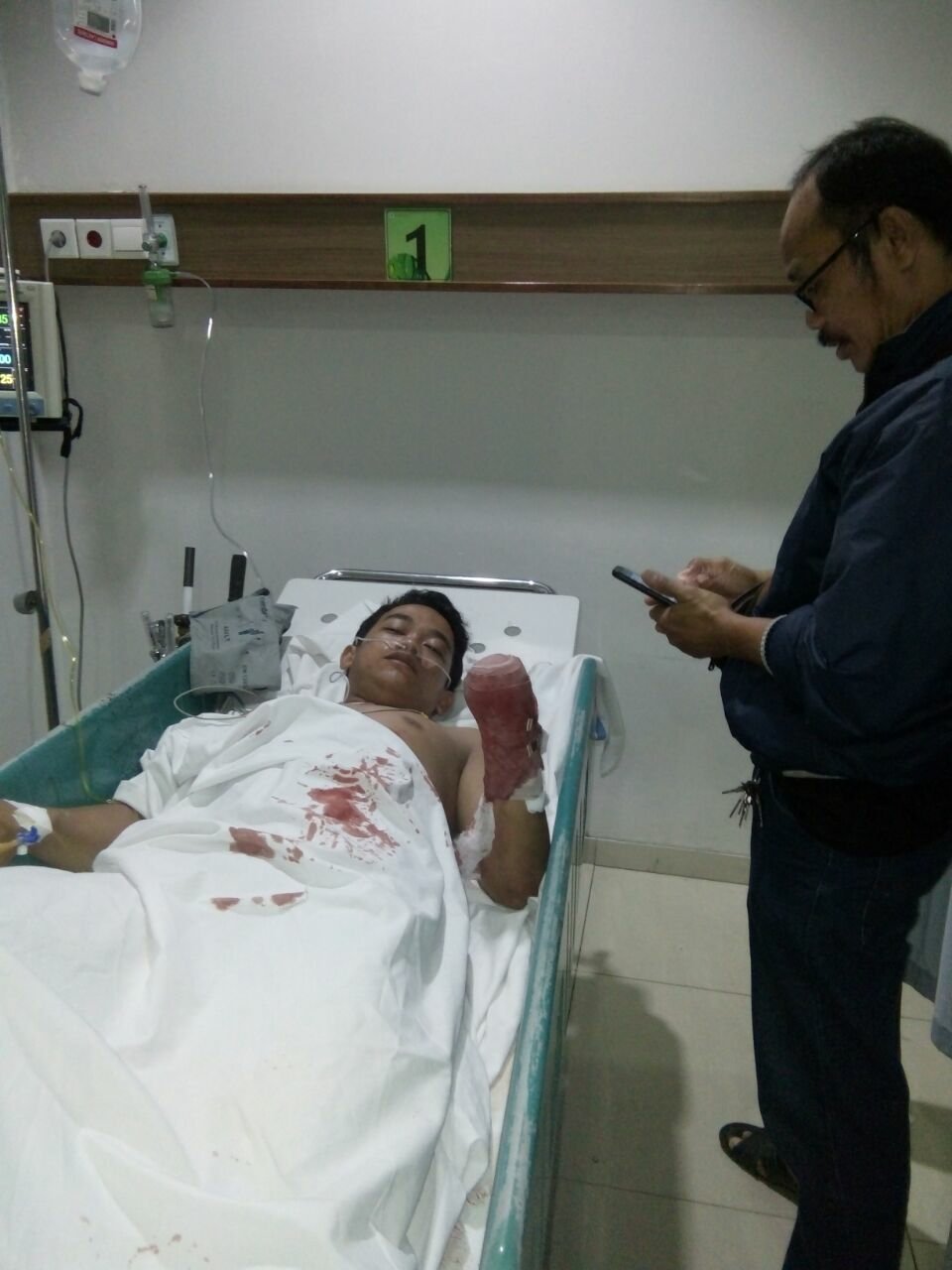 Tangkis Begal, Tangan Mahasiswa Enrekang Terputus