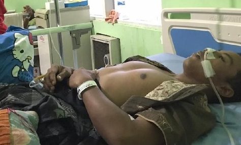 Istri Zaman Now di Probolinggo Injak Kemaluan Suami Sampai Pingsan