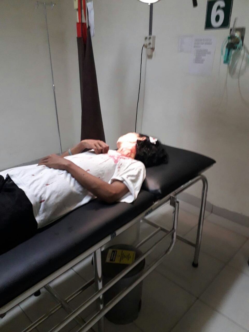 Seorang Pemuda Dianiaya Ditaman Elephan Park