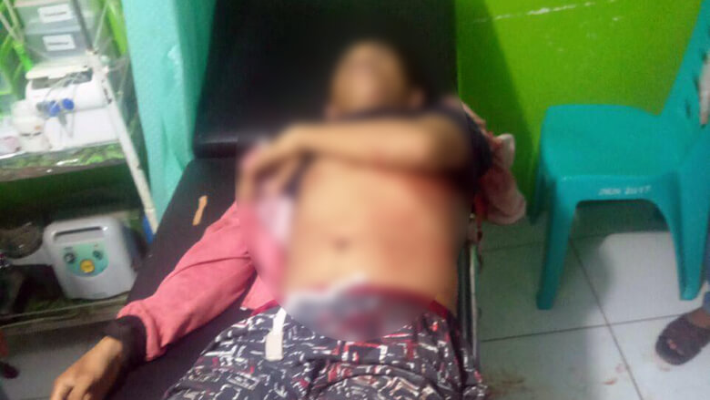 Petugas Puskesman Tewas Ditikam OTK Saat Hadiri Pesta Pernikahan