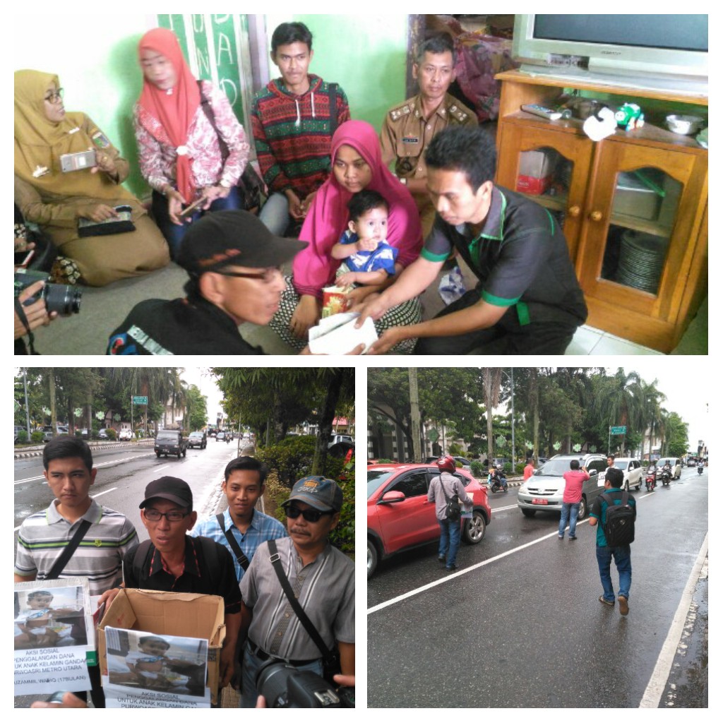 Jurnalis Kota Metro Gelar Aksi Sosial, Guna Membantu Bocah Berkelamin Ganda