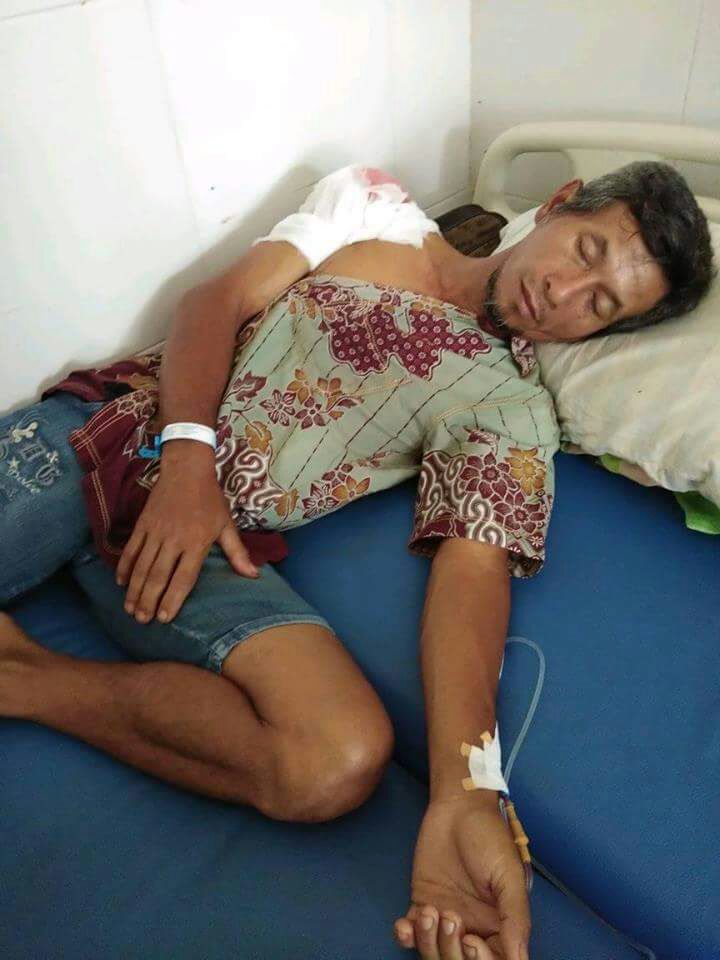 Begal Bacok Siwandi