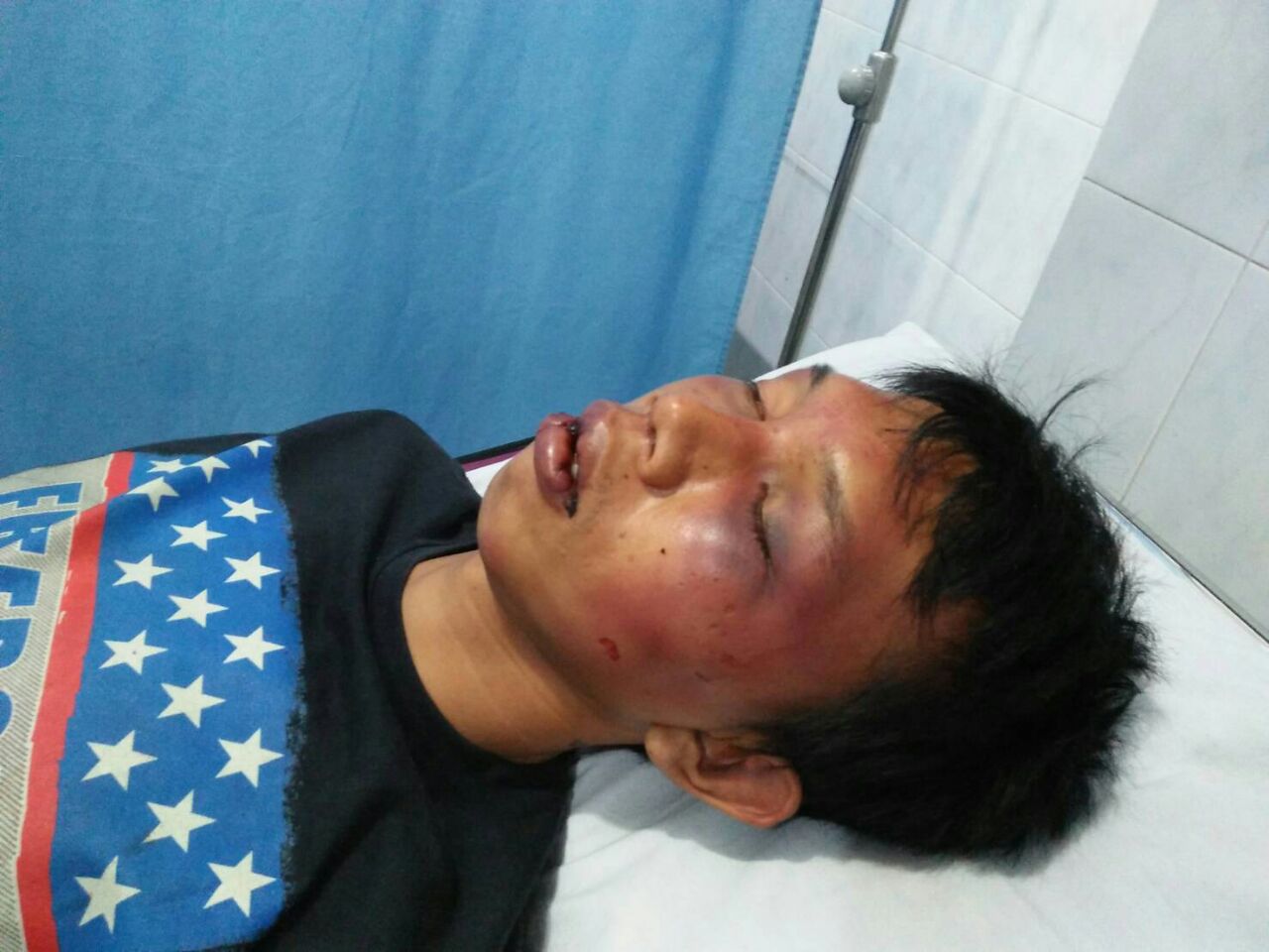 Kasus Kematian Yogi Andika, Polda Periksa Kerabat Bupati Lampung Utara Dan Saksi Oknum TNI