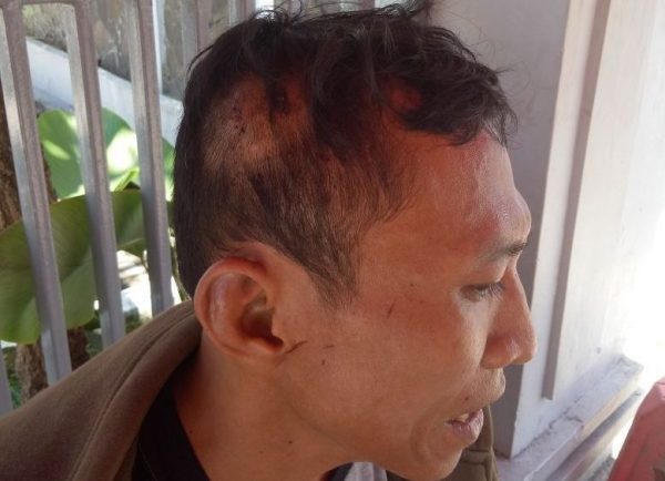 Korban Penyerangan di KP3B Minta Polda Banten Mengusut Pelaku Dan Dalang Pelaku