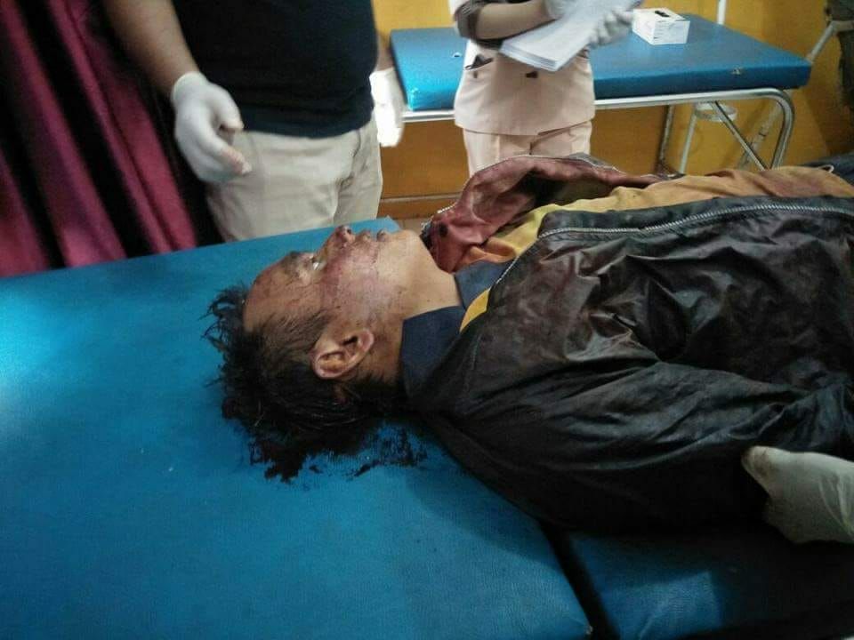 Duel Maut Dua Sahabat Satu Pemuda Tewas