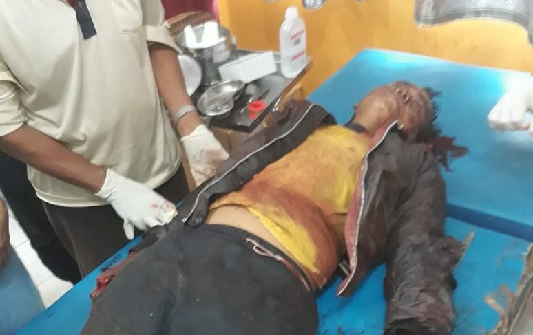 Mendra Bunuh Sahabatnya Yoga Karena Kesal Kerap “Dibulli”