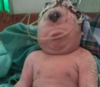 Bayi Perempuan Lahir Mirip “Dajjal” Bermata Satu Ke Tujuh di Dunia Itu Hanya Bertahan 7 Jam