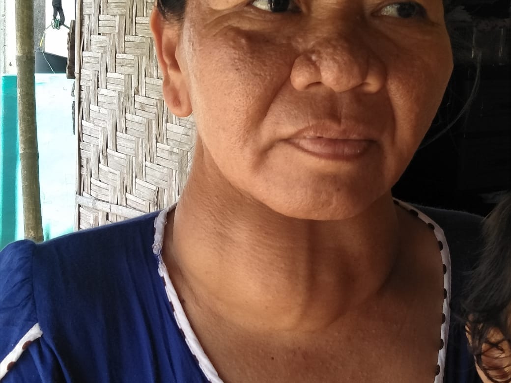 Hampir 7 Tahun Ngatemi Hidup Dengan Tumor, Guru Ngaji Ini Butuhkan Uluran Tangan