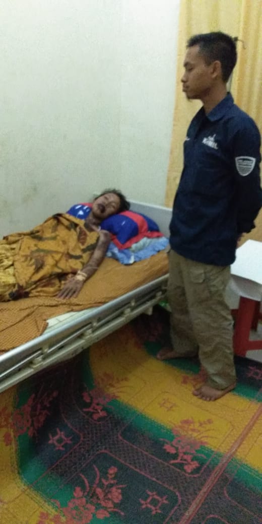 Dinkes Tanggamus Tangani Sunaini Penderita Tubuh Melepuh