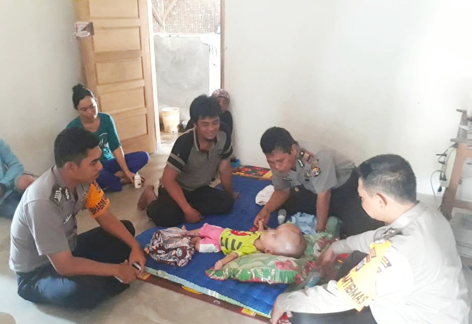 Polsek Dente Teladas Santuni Bayi Hydrocephalus