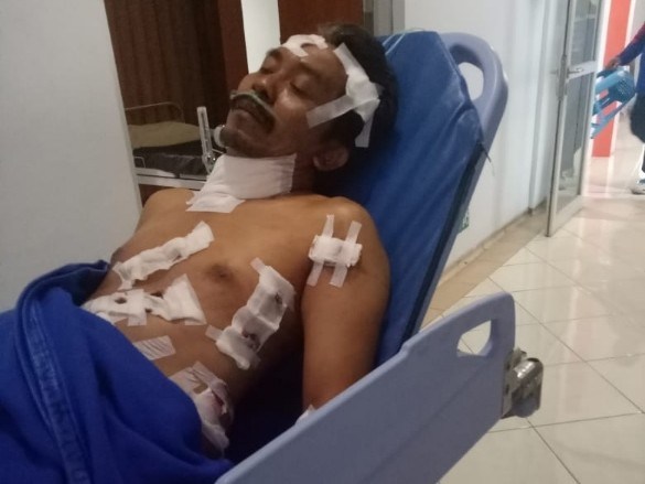 Driver Taksi Online Mojokerto Dirampok dan Ditusuk oleh Sekawanan Penumpangnya