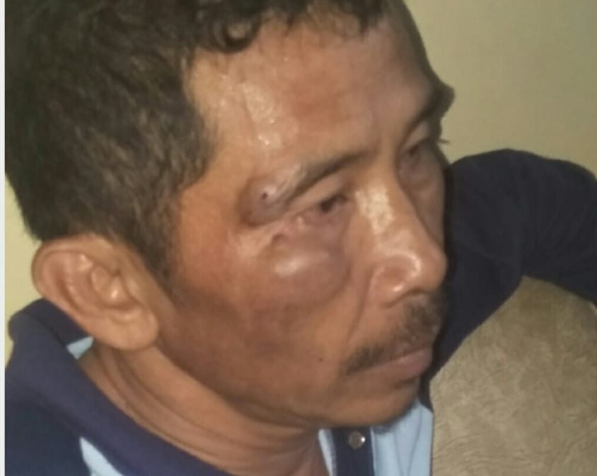 Sekdes Benjol Benjol Dikeroyok Dua Warganya