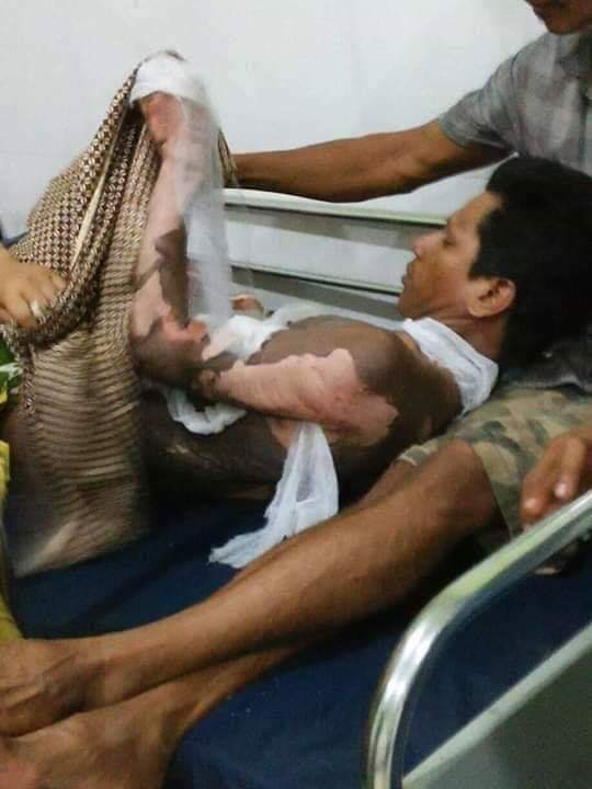 Gara-gara Pasword HP Istri Bakar Suami