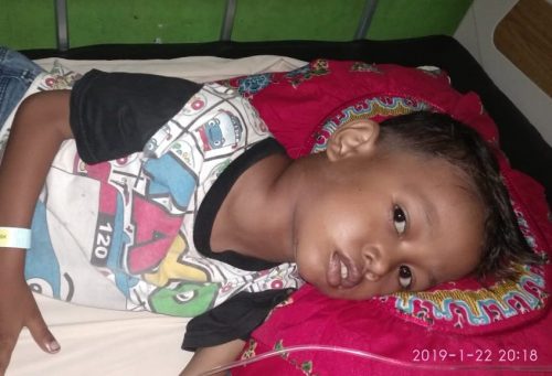 Catur Guntur Alfatir Bocah Penderita Tumor Bersarang di Leher Butuh Bantuan