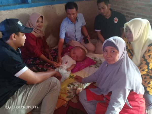 Komunitas Jum’at Berbagi Santuni Adrian Balita Hydrocephalus
