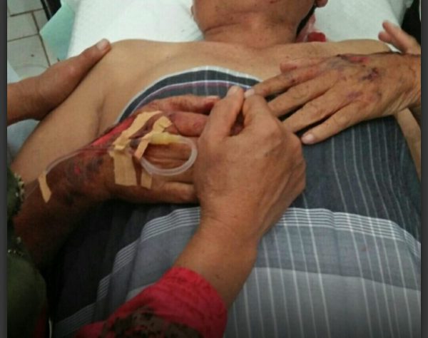 Pohon Tumbang Saat Hujan Deras Timpa Bapak dan Anak di Kota Agung