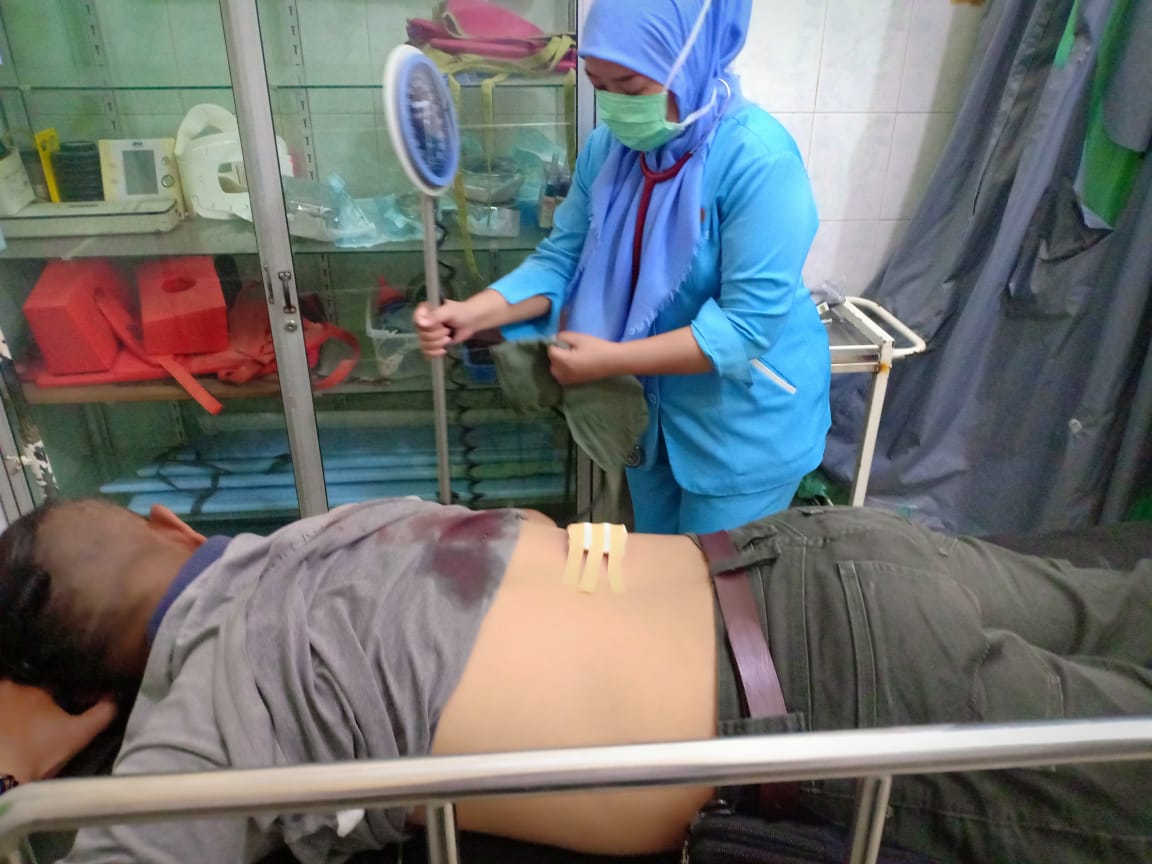 Asyik Duduk di Kantin Mahasiswa UBL Tertembak Pistol Polisi