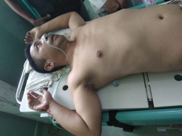 Kalah Tender, Keluarga Tokoh Tulang Bawang Aniaya Peserta Lelang ULP PUPR Tulang Bawang