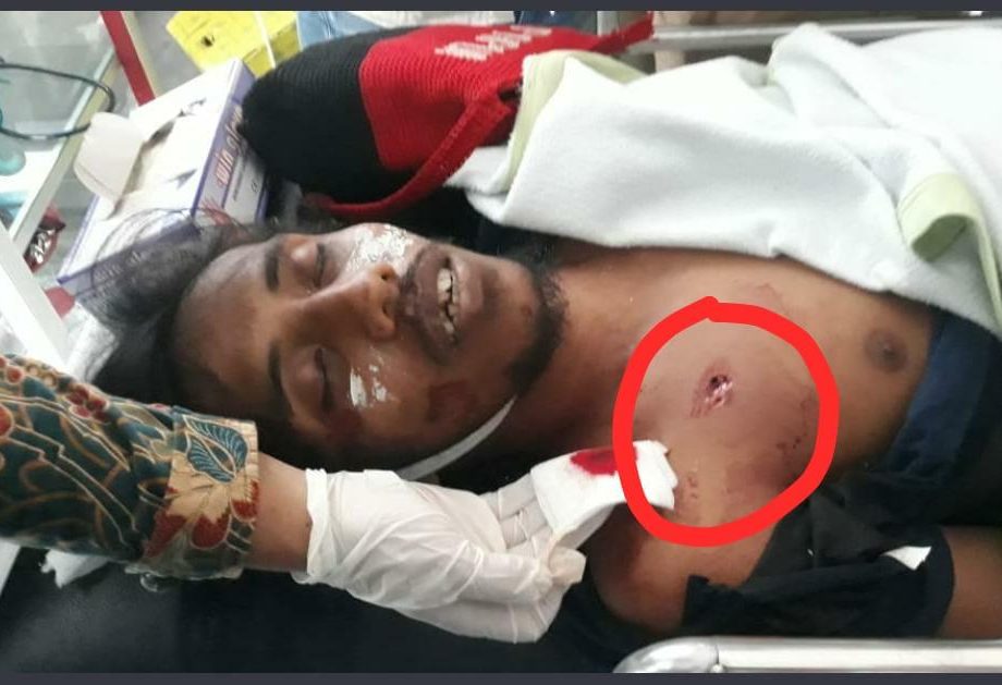 Randy Tewas Tertembak di Kendari PP Muhammadiyah Minta Kapolri Investigasi Langsung