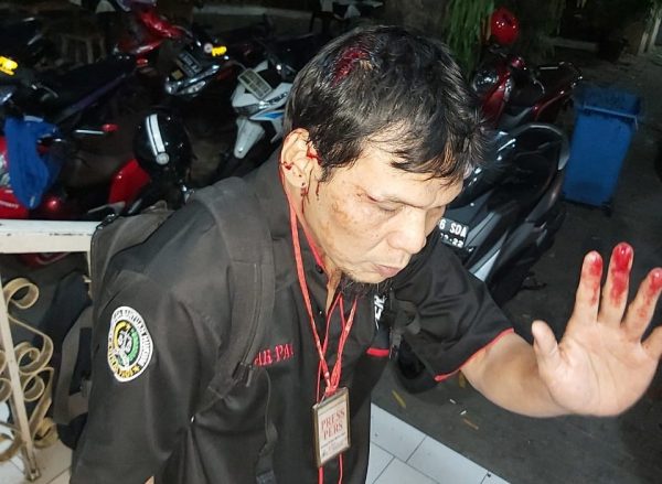 Wartawan Koran Sinar Pagi Jakarta “Digebukin” Polisi Saat Liputan