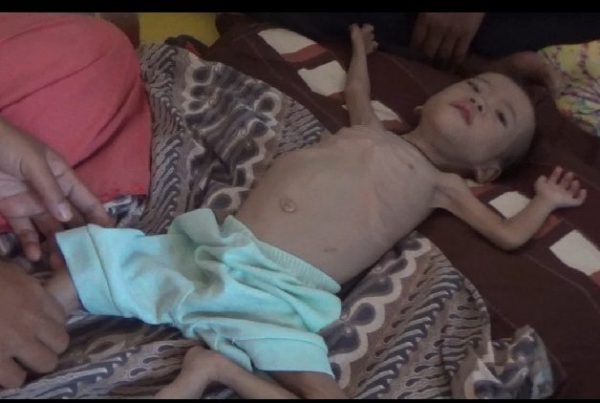 Balita Terdampak Stunting, Pemkab Tanggamus Terkesan Cuek